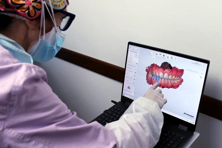 Controllo scansione 3d dentale